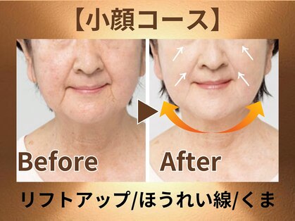 プライベートサロン レイ(Ray)の写真