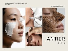 アンティエ
