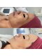 ブレスビューティー(BLESS BEAUTY)の写真/剥離なしハーブピーリングで毛穴・くすみを改善し、透明感あふれる艶肌へ。肌悩みによってプラズマも可◎