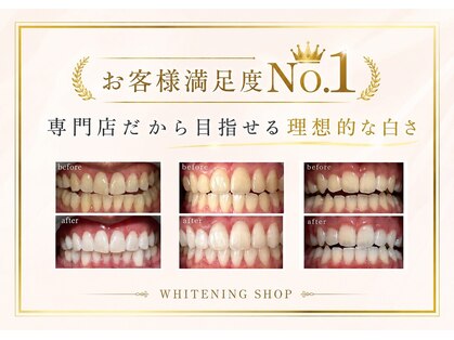 ホワイトニングショップ 上田店の写真