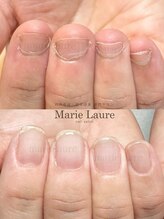 マリーロール 淀屋橋本店(Marie Laure)/自爪育成/深爪矯正/ネイルケア