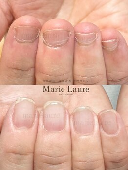 マリーロール 淀屋橋本店(Marie Laure)/自爪育成/深爪矯正/ネイルケア