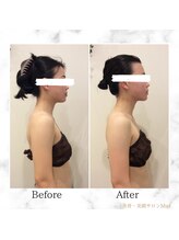ミエル(Miel)/Before After