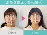 【小顔人気No.1】 小顔矯正 × 高周波最新機器 " WINBACK " 60分