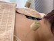命水鍼灸院の写真/【国家資格保持者が担当◎】頭痛や肩こり、腰痛にお困りの方必見！根本改善ができる鍼灸院が登場★