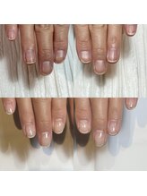 キュア(Cure.)/看護師のお客様の自爪育成ネイル