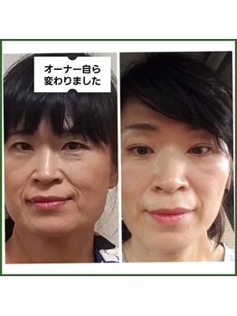 サロンド ベレーゼ/一生モノの肌質改善