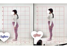 アモーラ(Amora)/ぽっかり見えていたお腹もストン