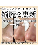 ピュール 鯖江店(PUR)/毛穴サロン/毛穴ケア/毛穴洗浄