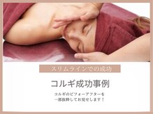 スリムライン 盛岡店(The Slim Line)/コルギbefore→after