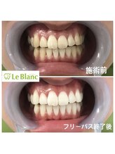 ルブラン 奈良店(Le Blanc)/老若男女問わず人気！