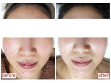 ミュー(Mieux)/Mieuxに出会えてよかった