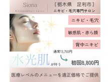 シオナ(Siona)