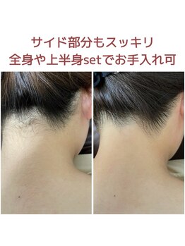 ビーボヌール(be-bonheur)/　脱毛×肌管理で叶える品格美容