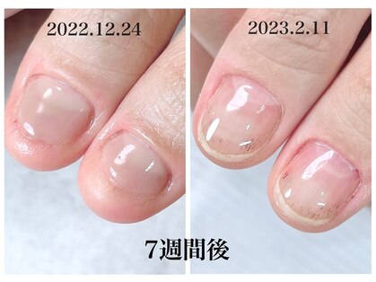 エレアネイル(elea.nail)の写真