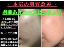 シロ チューズミー(Shiro choose me)の雰囲気（美肌メニューあり◎お肌のお悩みお任せ!!肌質改善×育肌）