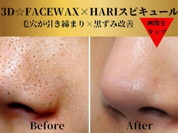 ベルアンドヘルス 千葉(BELL&HEALTH)/HARIスピキュール×FACEWAX