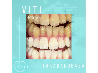 ヴィティ 高田馬場店(viti)の写真