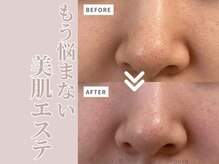 リボーン(Reborn)の雰囲気（繰り返す毛穴・ニキビケア・シミのお悩みお任せください!！）