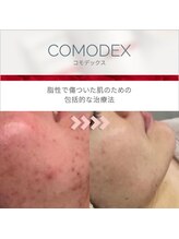 ビューティ スペース ルーチ(beauty space Luci)/肌質改善にクリスティーナ◇