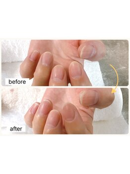 角質ケアができるサロン