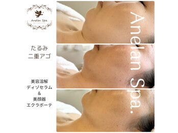 アネランスパ(Anelan Spa.)