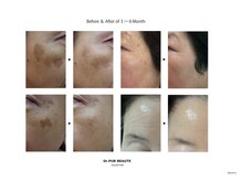 マベール/Dr.PUR &nbsp;BEAUTE お客様結果