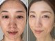 トータルエステティック ジョワイユ(JOYEUX)の写真/【お肌が変わると人生が変わる】大人の肌は、ここから変えられる！美肌管理
