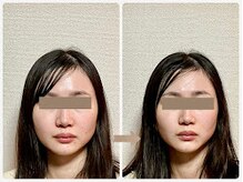 哲心 姫路/写真写りが気にならならないです