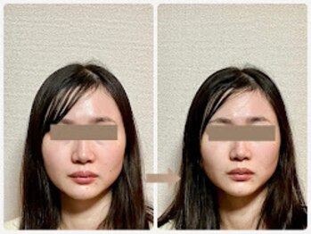 哲心 姫路/写真写りが気にならならないです