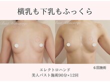 エイミー(Aimee)/バスト施術12回