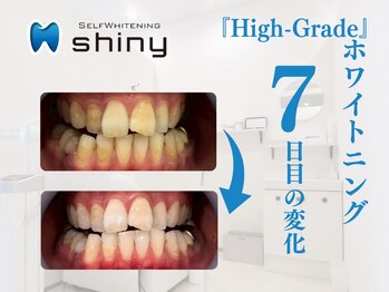 ホワイトニングサロン シャイニー 浜松細島店(shiny)/【超絶・美・白】ホワイトニング