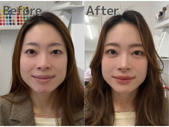 シロイロ(shiroiro)/ビフォーアフター