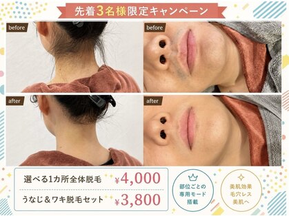 ワイズサロン(Y's salon)の写真