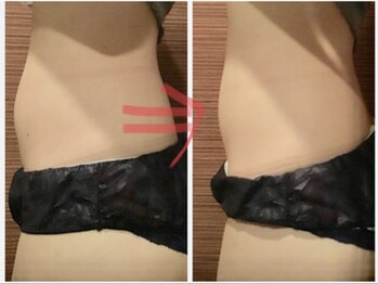 極めリラクゼーション/ハイパーナイフ