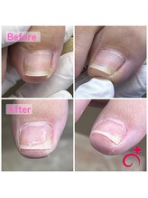 Dr.巻き爪 川越店/