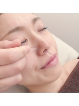 ももとゆでたまご/小鼻の毛穴が気になりますか?