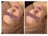 【脱毛・美白・水光肌】ララピール＋お顔脱毛+高濃度美容液導入+ヘッド 90分 
