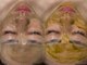 セレソル(CERESOL)の写真/【ヒト臍帯血由来幹細胞培養液×2種のハーブピーリング】細胞レベルで肌本来の再生力にアプローチ！