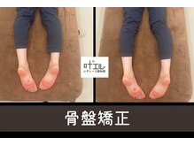 叶'エル 本町 心斎橋院/姿勢改善　骨盤矯正