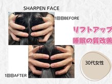 ミラ(Mira...)/☆Before→After☆