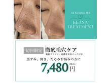 エーケーエステティックス 熊本新市街店(AK Esthetics)の雰囲気（【毛穴洗浄】固まってしまった頑固な黒ずみはAK式毛穴洗浄で☆）