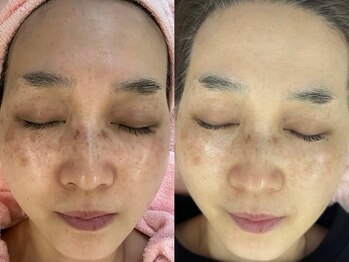 エヴェリーナ(Eveliiina)/22回目のお写真です。