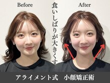 アライメントトウキョウ 麻布十番(Alignment TOKYO)/食いしばりが大きくさせる☆