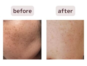 リジェネラティブセル メディカルサロン(Regenerative Cell Medical Salon)/ビフォーアフター