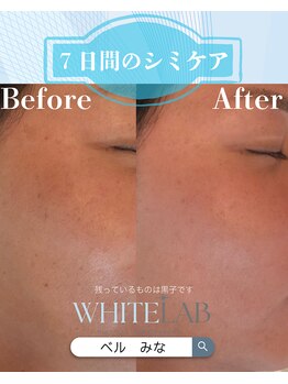 ベル(BELLE)/ホワイトラボ