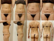 プリマ 栄店(Prima)