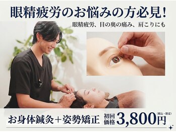 西宮しおり鍼灸整骨院 整体院の写真/【目の奥の痛みがある方必見◎】お身体鍼灸＋姿勢矯正《3800円》限定価格◆眼精疲労を根本的改善◆