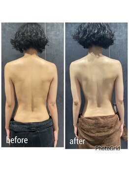 ククナ(KUKUna)/背中の浮腫みもスッキリ