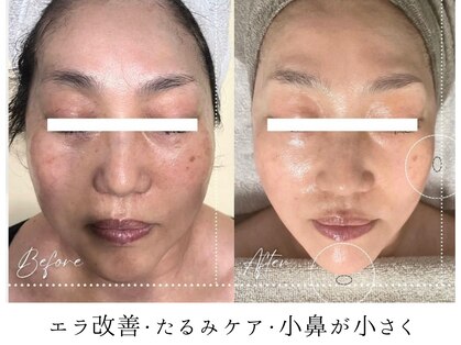 パーム(Perm)の写真